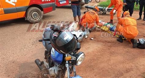 Mulher Sofre Fratura Exposta Na Perna Ap S Ter Sua Moto Atingida Por