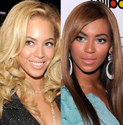 Celebrities And Skin Whitening |Skin Whitening Remedies