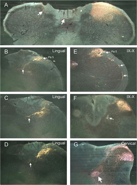 Frontiers Somatotopy In The Medullary Dorsal Horn As A Basis For