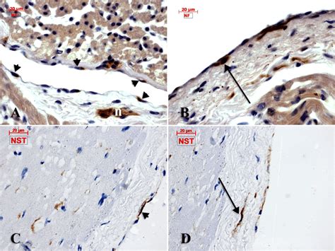 Expression Of Neural Markers In Human Adult Samples Of Right Atrium A