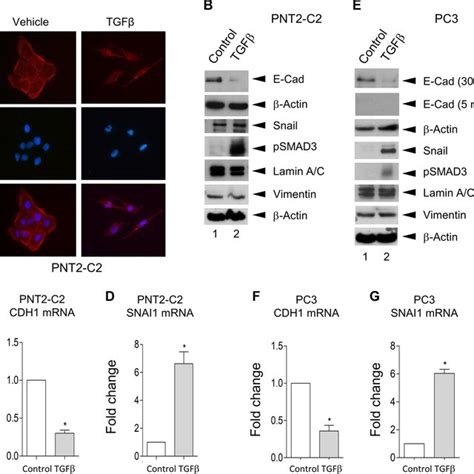 TFGβ induces EMT like changes in PNT2 C2 cells and PC3 cells ad