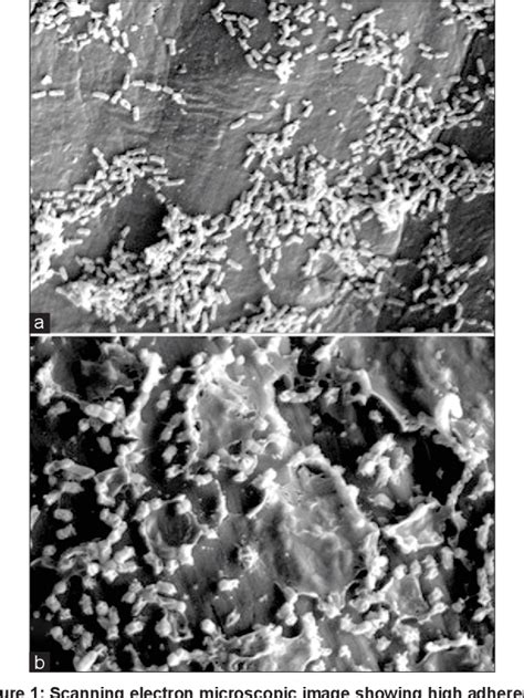 A Comparison Of Bacterial Adhesion And Biofilm Formation On Commonly