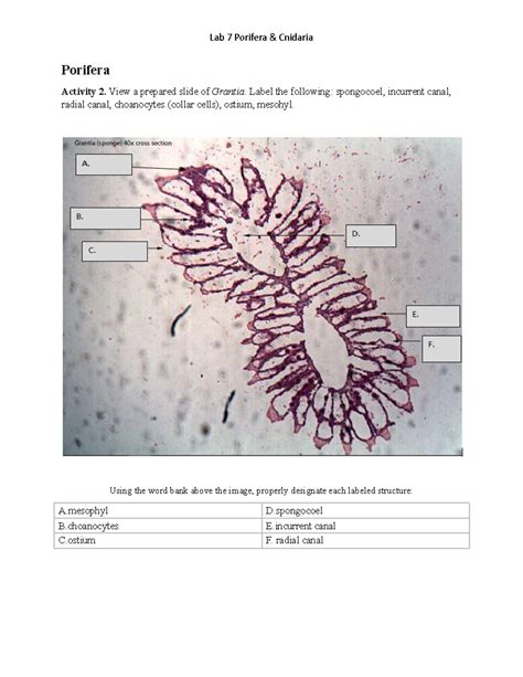 7 Porifera Cnidaria Porifera Activity 2 View A Prepared Slide Of