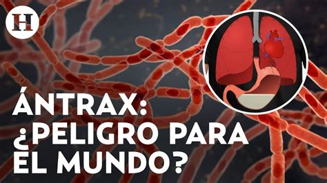 Alerta por brote de Ántrax en África enciende alarmas así se contagia