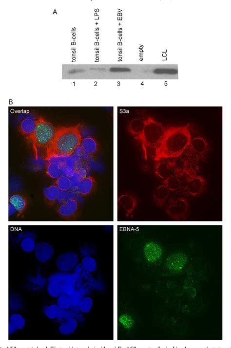 Epstein Barr Virus Encoded EBNA 5 Binds To Epstein Barr Virus Induced