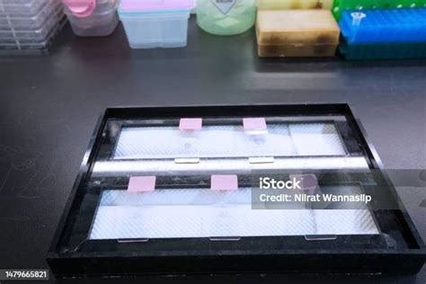 Stock Fotografie Imunohistochemické Barvení V Histopatologii Stáhnout