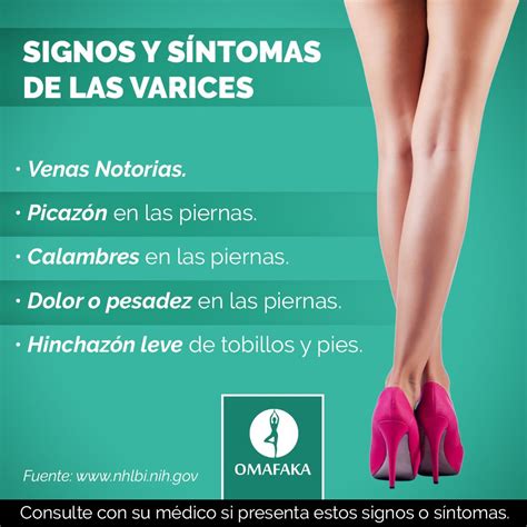 Conoce Algunos Signos Y Síntomas De Las Varices Para Poder Prevenirlas Piernasbonitas Varices