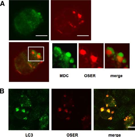 Sequestration Of OSER Into Acidic Vacuoles And Colocalization With The