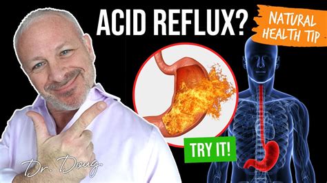 Acid Reflux Home Remedy That Works Dr Doug Willen Youtube