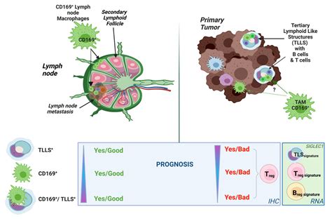 Cancers Free Full Text Cd169 Macrophages In Primary Breast Tumors