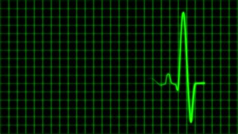 Cardiogram Cardiograph Oscilloscope Screen With Grid Green Loop Stock