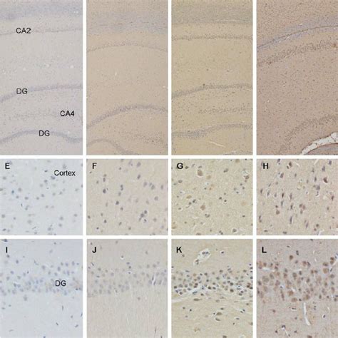 Immunohistochemical Staining Of Phosphorylated Tau Coronal Rat Brain