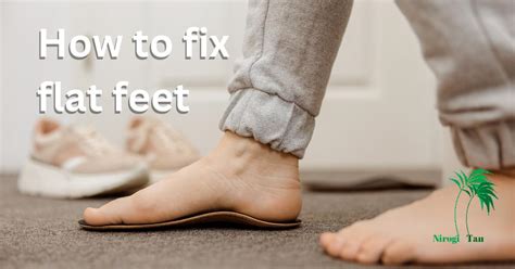 How To Fix Flat Feet Nirogi Tan