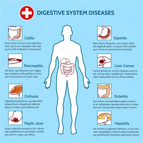 Diseases Of The Digestive System Chart