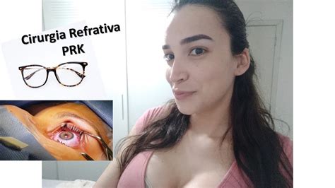 Cirurgia Refrativa Prk Miopia Astigmatismo Meses Youtube