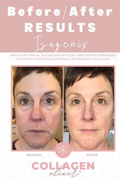 Isagenix Collagen Elixir Review Before And After Photos 2024