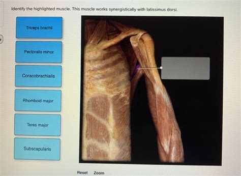 Solved Identify The Highlighted Muscle This Muscle Works Chegg