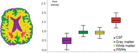 Semisupervised White Matter Hyperintensities Segmentation On Mri