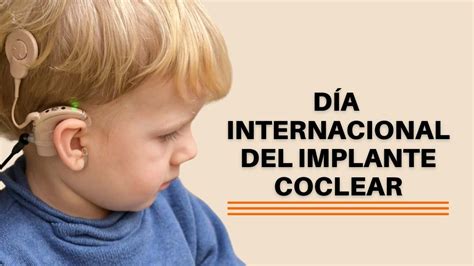 De Febrero D A Internacional Del Implante Coclear Revista Marketing