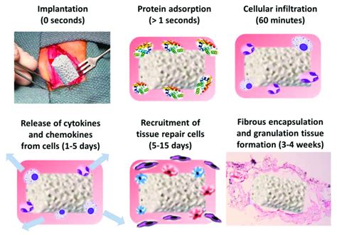 Implantation Of The Scaffold Into The Body Reprinted With Permission