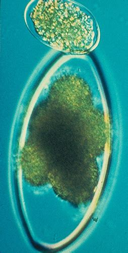 Parasite Eggs Flashcards Quizlet