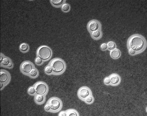 Fungi classification depending on cell morphology | Medical Laboratories