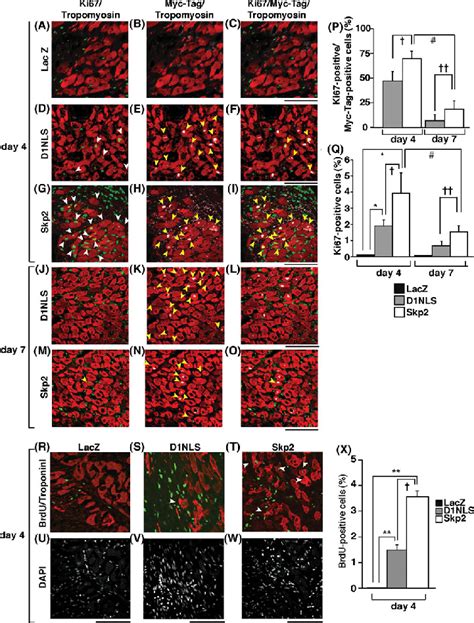 Immunostaining Of Ki Or Brdu Postitive Cardiomyocytes In Vivo Aq