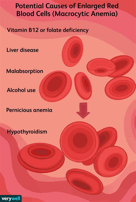 Macrocytic Anemia Symptoms Causes Treatment And More