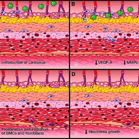 Novel Adventitial Delivery Of Vascular Endothelial Growth Factor A