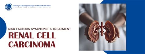 Renal Cell Carcinoma Understanding The Risk Factors Symptoms And Treatment