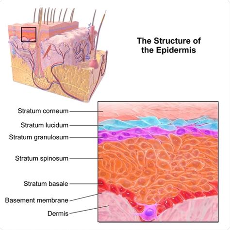 What is Inflammatory Linear Epidermal Nevus?