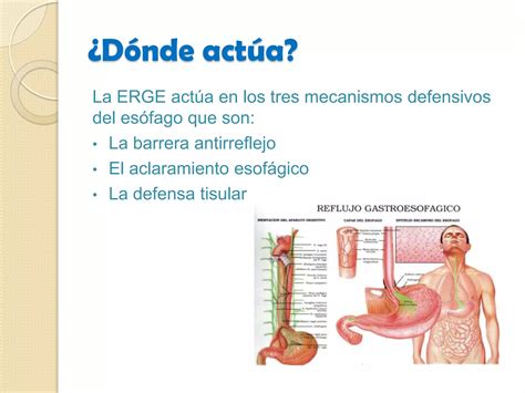 Reflujo GastroesofÁgico Ppt