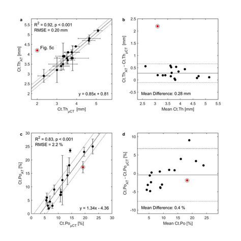 A Correlation Between Cortical Thickness Estimated From Ultrasound