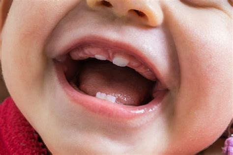 Les dents de bébé apparaissent à quel âge Dentiste pour Enfants