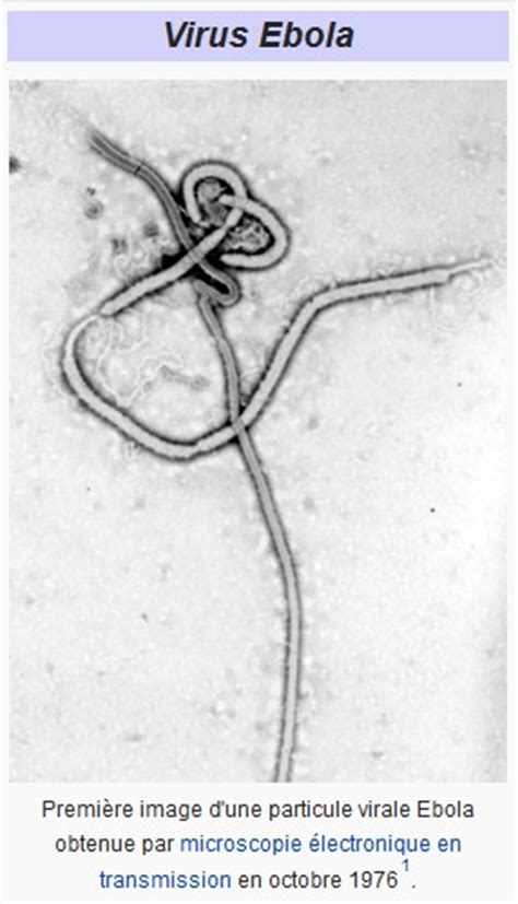 Le Virus Ebola Et L Pid Mie Il Fait Toujours Beau Quelque