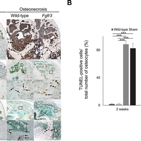 Osteoclast Numbers Increased In The Fgfr3 Mice At The Early Phase