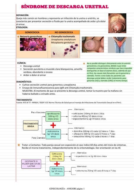 Síndrome de Descarga Uretral Ivon Gonzalez Rivera uDocz