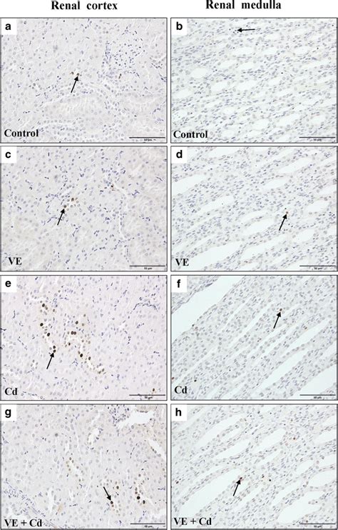 The Renal Cell Apoptosis By Tunel Assay Note Ab Control Group