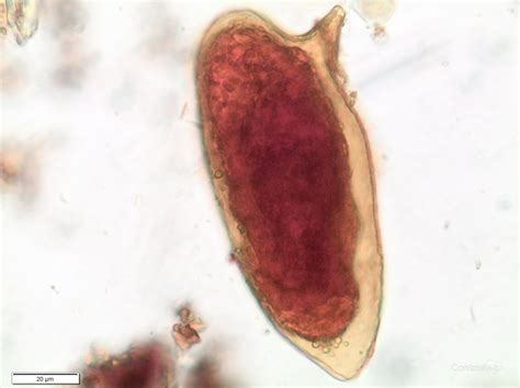 Parasitología Controllab