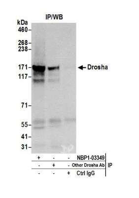 Ncrna Processing Pathway Bioinformatics Novus Biologicals