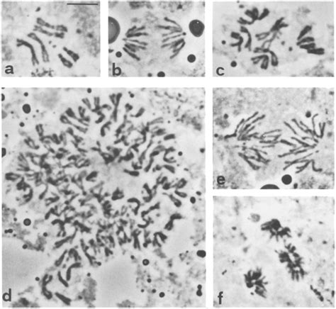 Mitotic Defects In Larval Neuroblasts Of Tsr Mutants A Diploid