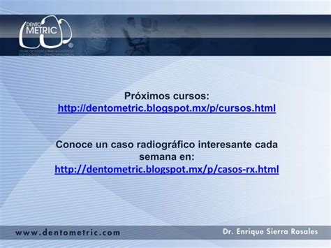 Fractura Mandibular PPT Descarga Gratuita