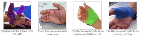 The Peripheral Nerves A Quick Assessment Of Nerve Functioning Or Rock