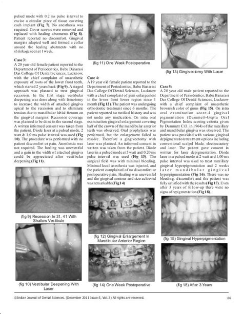 Diode laser applications in periodontics