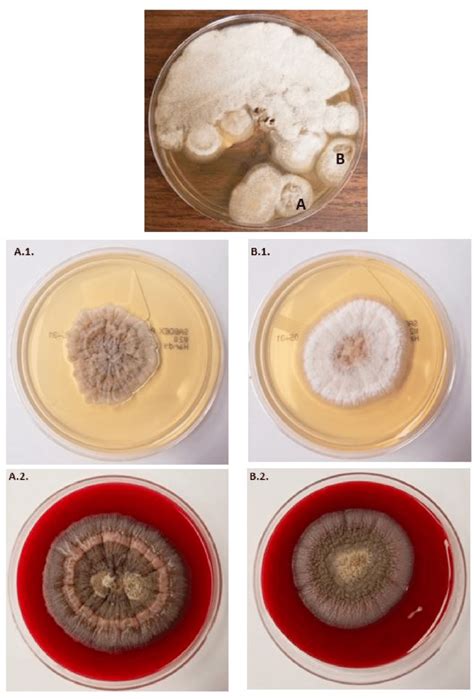 Colony Morphology On Sabourauds Dextrose Agar A1 And B1 And