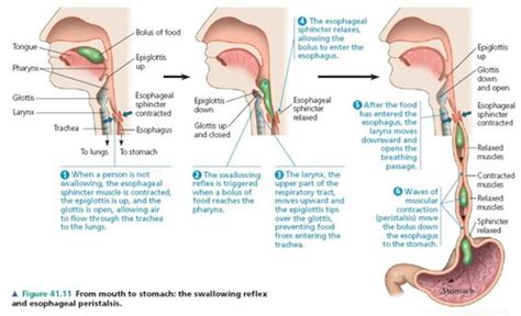 Esophageal Disorders Flashcards Quizlet