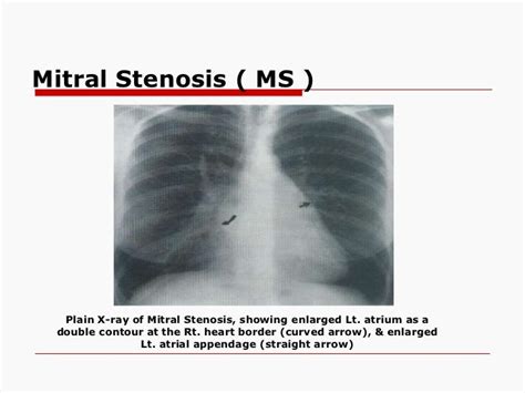 Radiology 5th Year 14th Lecturepart Two Dr Abeer