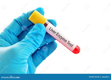 Liver enzyme test stock image. Image of chemistry, cirrhosis - 65172159