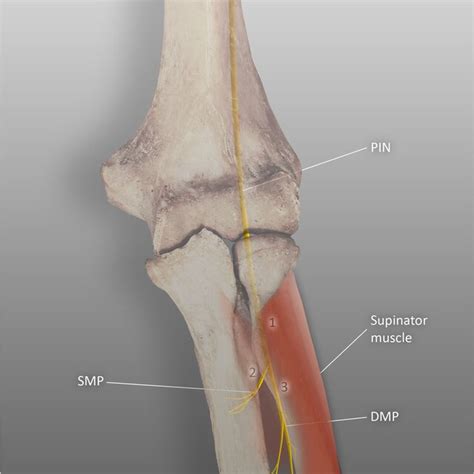 Course Of The Radial And Median Nerves In The Nine Zones RN Radial