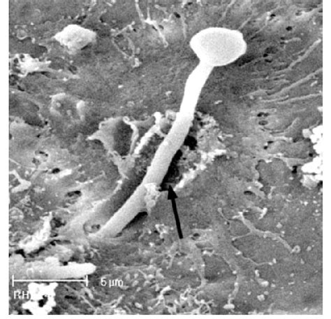 Hyphal Element Of Candida Albicans Invading The Epithelium With Marked